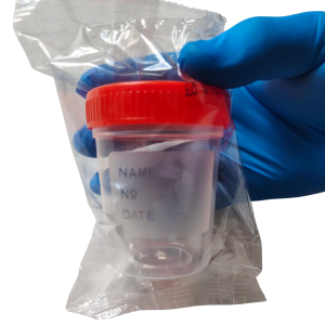 Contenedor de Orina Estéril